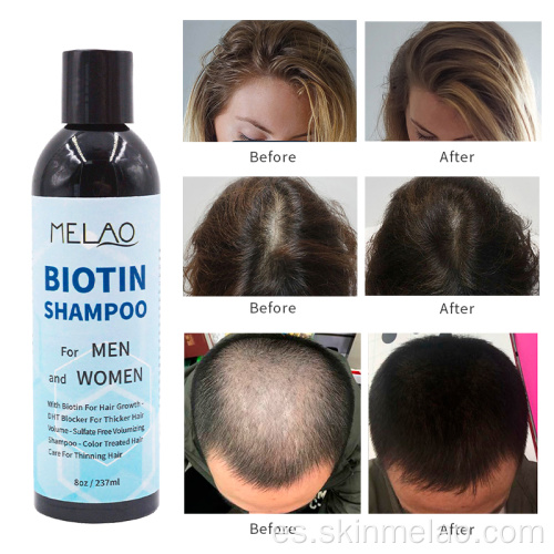 Champú para el cabello de biotina para hombres y mujeres